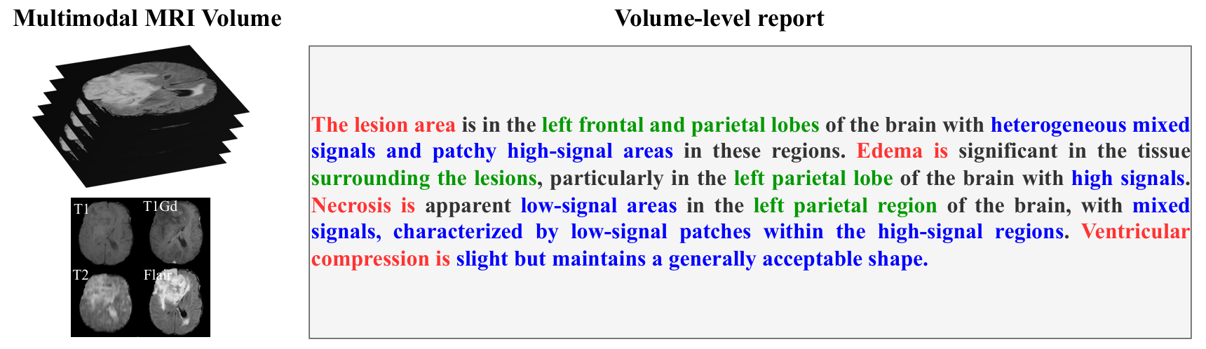 TextBraTS datasample